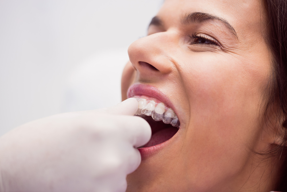 dentist holding Invisalign orthodontic retainers in a dental clinic